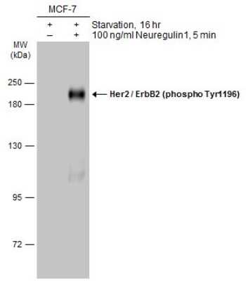 Western Blot: ErbB2/Her2 [p Tyr1196] Antibody [NBP3-13268] - Untreated (-) and treated (+) MCF-7 whole cell extracts (30 ug) were separated by 7.5% SDS-PAGE, and the membrane was blotted with ErbB2/Her2 (phospho Tyr1196) antibody (NBP3-13268) diluted at 1:1000. The HRP-conjugated anti-rabbit IgG antibody (NBP2-19301) was used to detect the primary antibody.